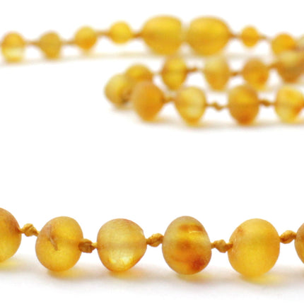 Amber Honey Raw Children Necklace-2