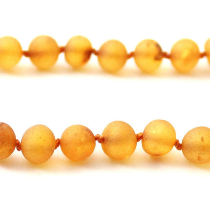 NBAR-2 Amber Raw Golden Honey Necklace for Adults-3