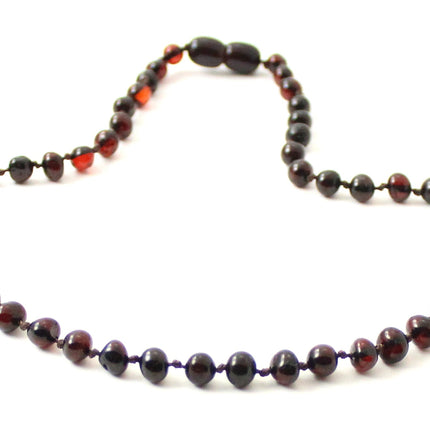 Baltic Amber Cherry Kids Necklace-2