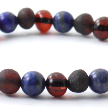 Amber Black Cherry Stretchy Bracelet With Blue Lapis Lazuli-3